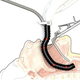 Image for article titled Oh Great, Surgeons Want To Shove These Robot Snakes Down Our Throats